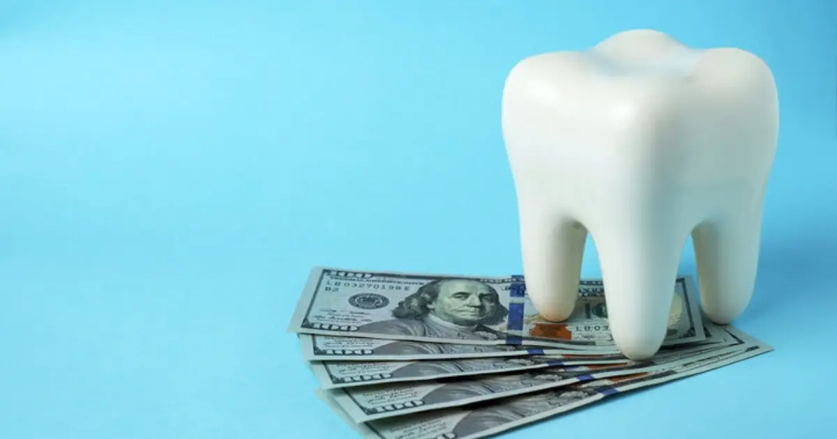 How Much Is All-on-4 in Michigan_