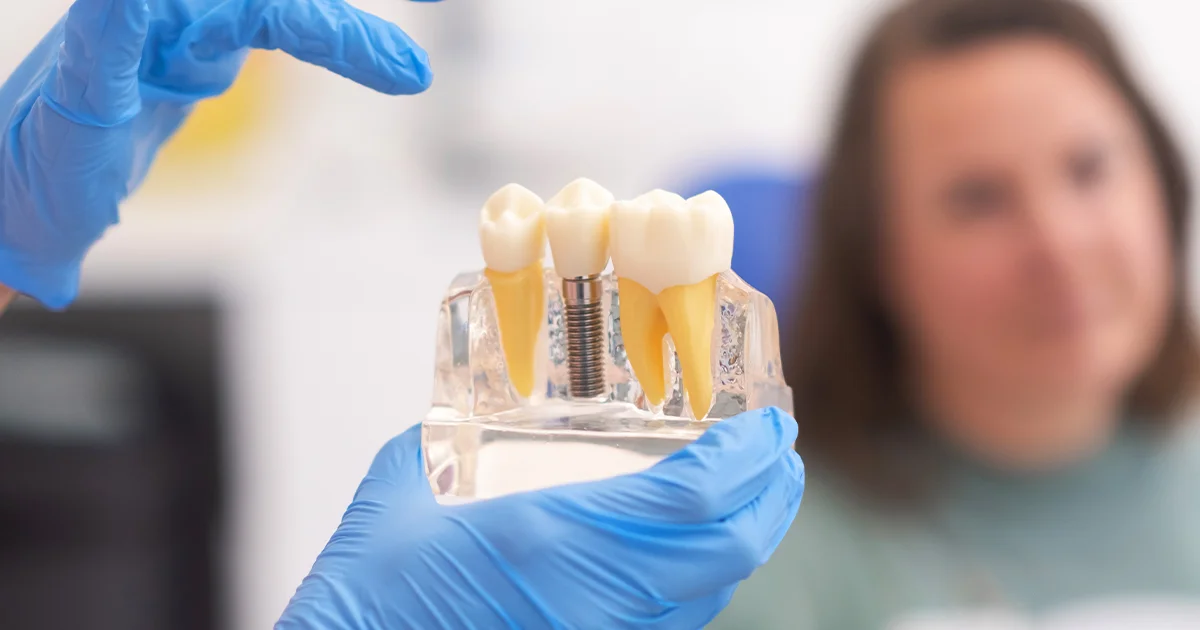 Dental Implants Flint MI: Advanced Care at All Michigan Implants