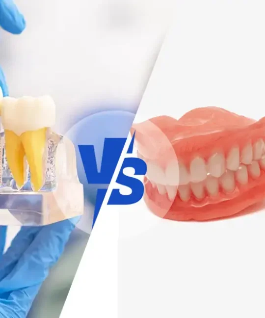 dental implants vs dentures