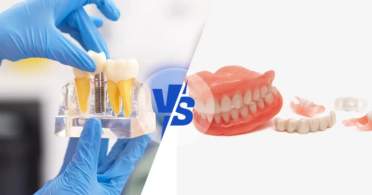 dental implants vs dentures